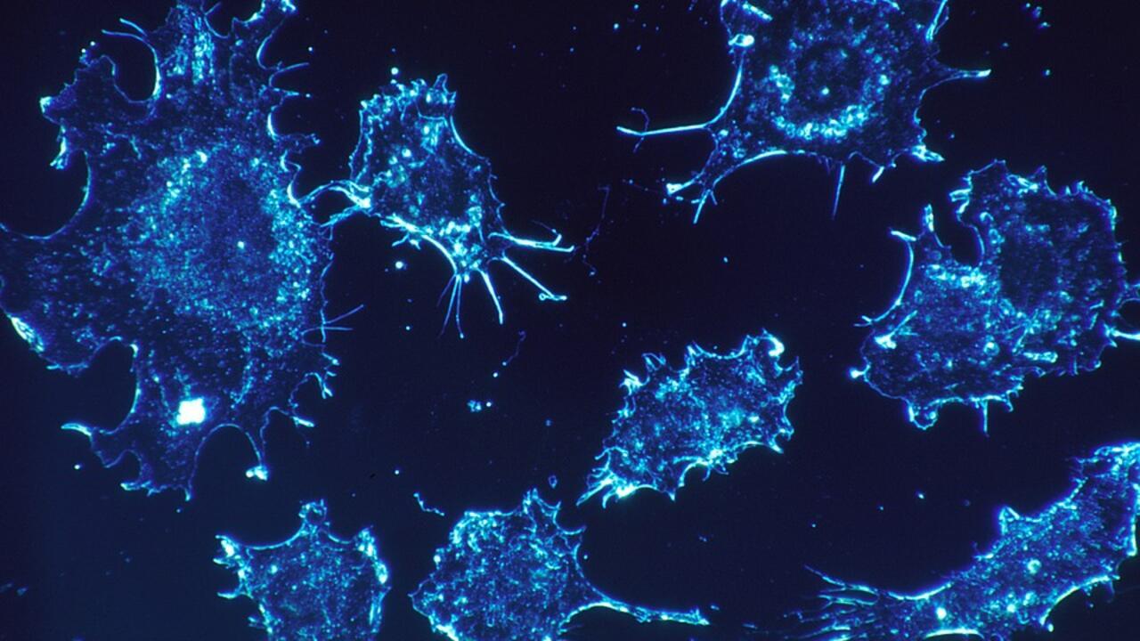 Des essais chinois affichent des avancées majeures dans la lutte contre le cancer du poumon