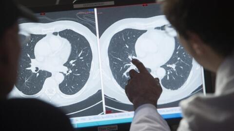 Un medic arată pe o radiografie infecția cu virusul HPV, Bethesda Center, Maryland, Statele Unite, februarie 2018.