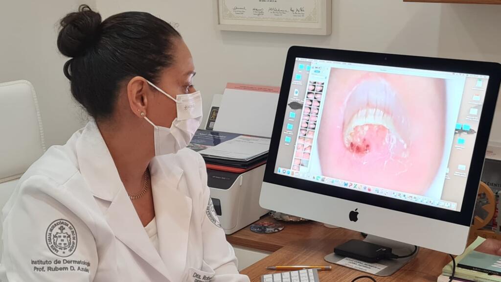 A médica Robertha Nakamura é uma estudiosa da onicologia, uma subespecialidade da dermatologia.