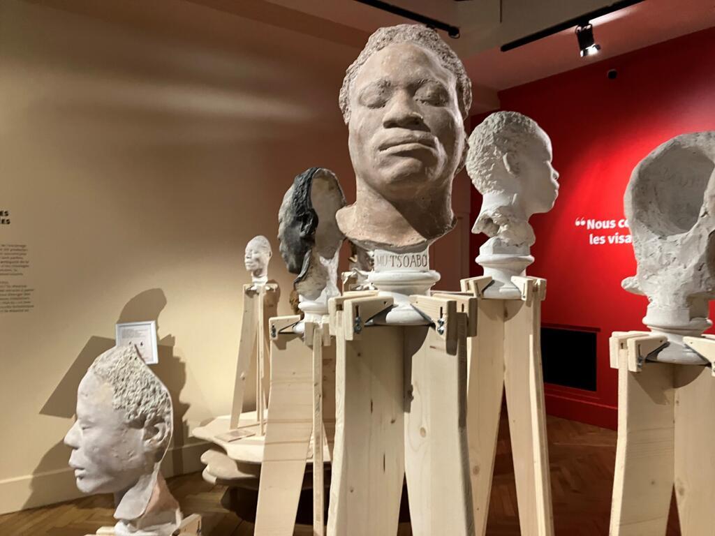 Des cheveux et des cils ont été retrouvés empoisonnés dans le plâtre.