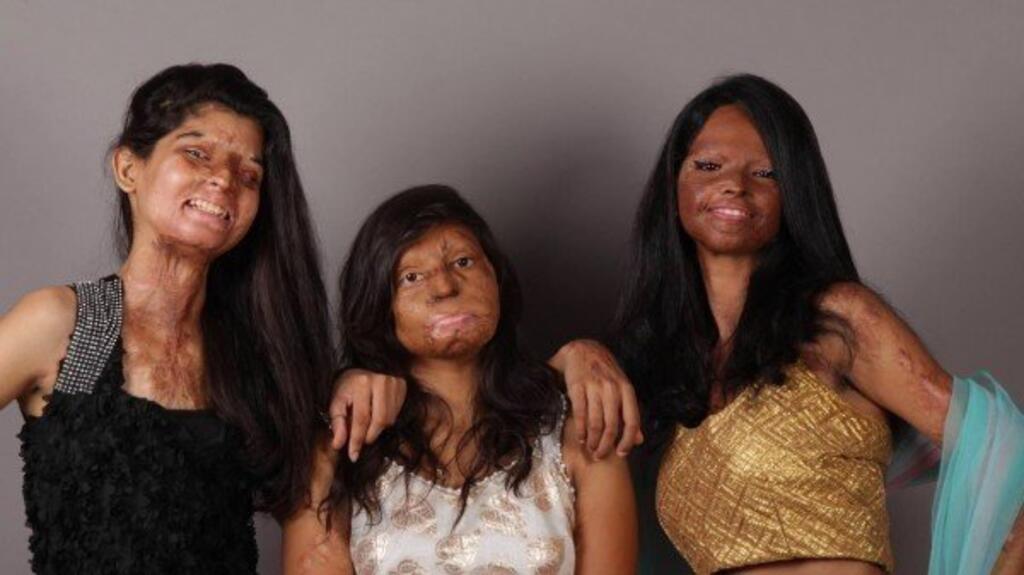 Smiling through the pain: some of India's acid attack victims.