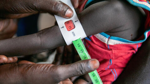 La circonférence du bras d'une petite fille est mesurée pour dépister une éventuelle malnutrition à Torit, au Soudan du Sud par le PAM de l'ONU, en 2022.