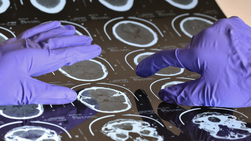 Realidade virtual ajuda neurocirurgiões a identificarem áreas que devem ser preservadas durante a intervenção para curar lesões
