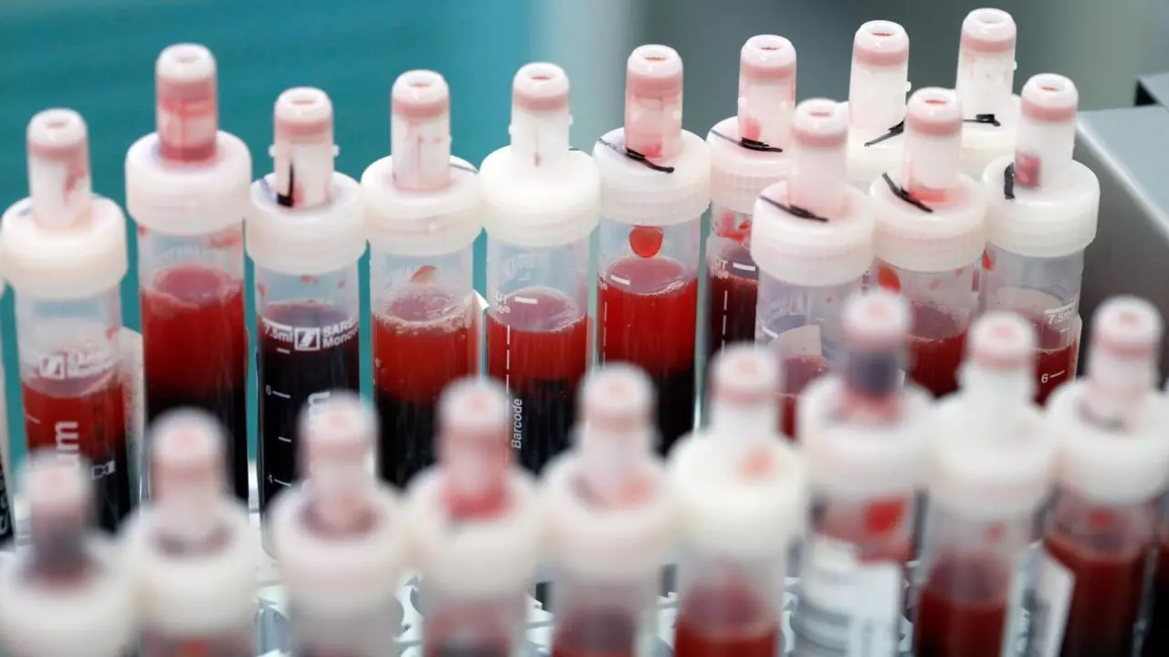 Espanha Bate Recorde De Mortos E Enfrenta Polemica Por Testes Ineficazes Para Coronavirus