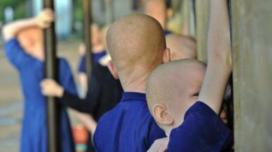 Les enfants albinos sont en danger dans beaucoup de pays d'Afrique.