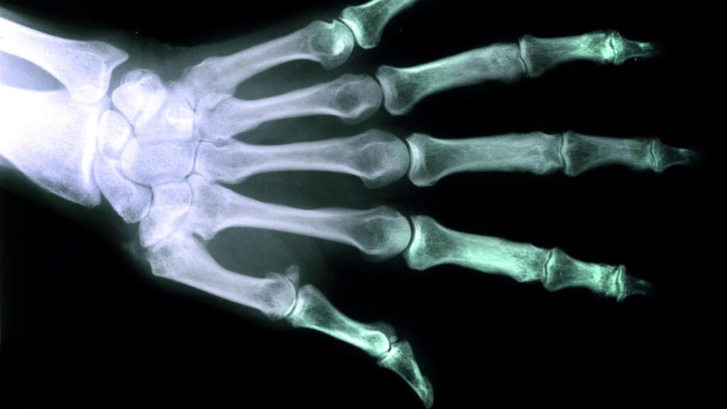 Une société danoise a mis au point une méthode d'impression 3D d’implants osseux parfaitement adaptés au corps.