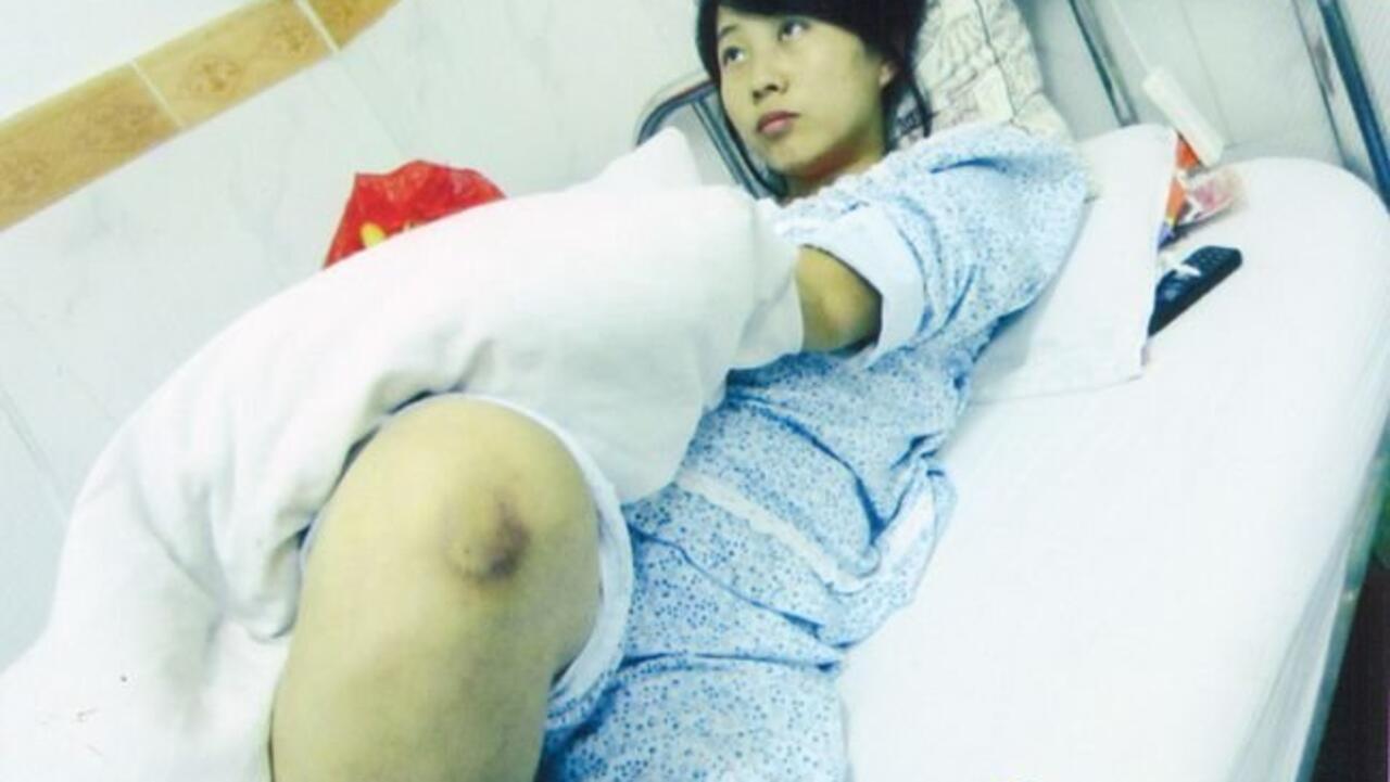 陕西镇坪7月大胎儿强制引产事件引起中国左右同声谴责 陕西镇坪7月大胎儿强制引产事件引起中国左右同声谴责