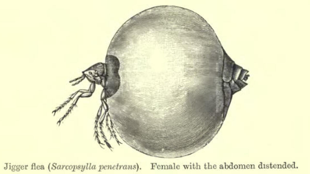 Opposition politicians step up fight against jigger infestation