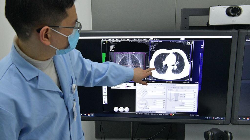Scanner à distance assisté par 5G utilisé pour diagnostiquer les patients Covid-19 en Chine (image d'illustration).