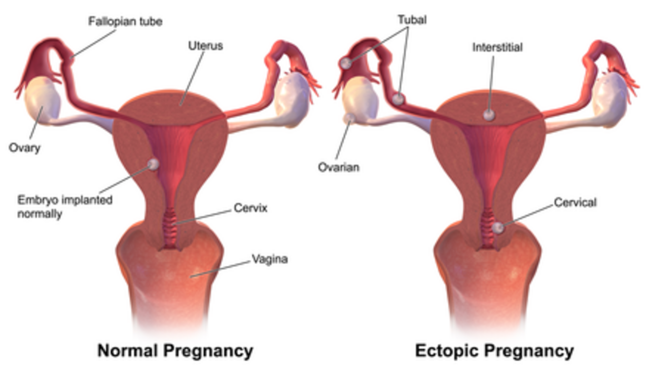 Yalangoch xitoylik qizlarning fotosuratlari