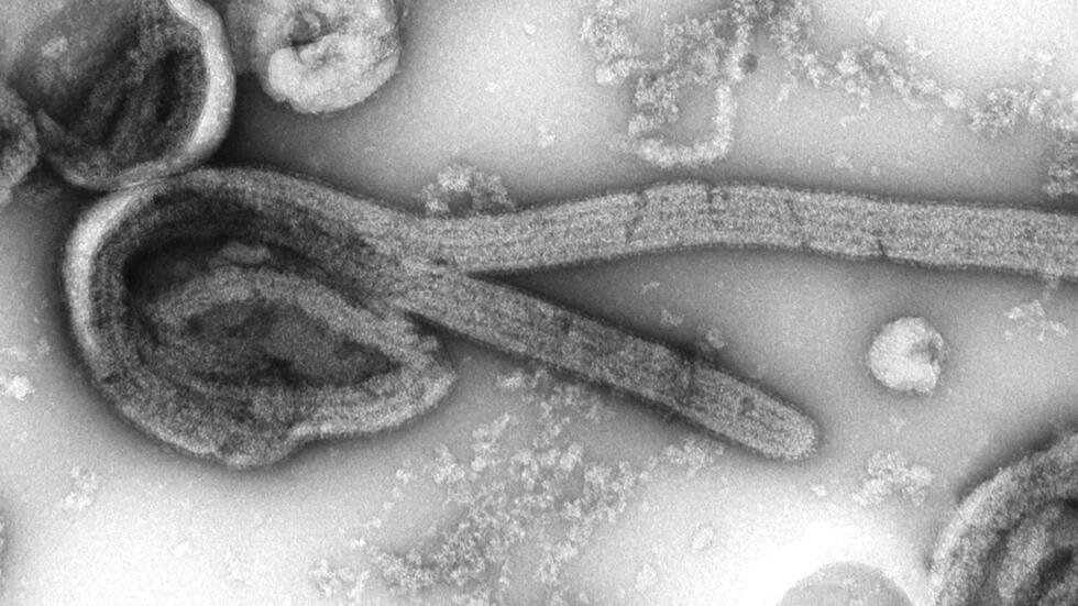 Dalili kuu za homa hii ni pamoja na maumivu makali ya kichwa, misuli, kutapika, na kuhara, raia wakitakiwa kifika kwenye vituo vya afya pindi wakionesha dalili hizi.