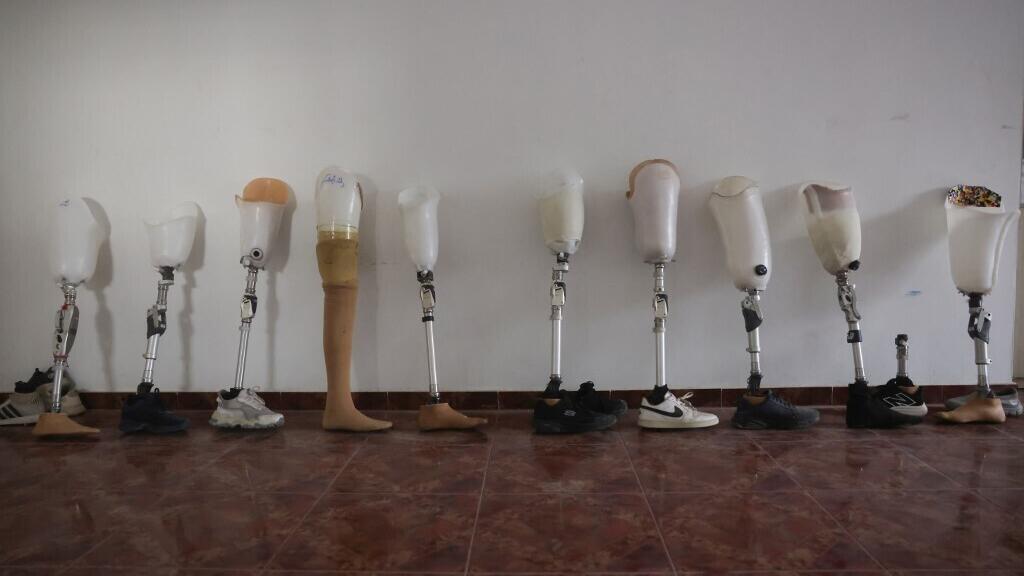 Gaza: après deux ans de guerre, 6000 prothèses de membres sont nécessaires selon Handicap International