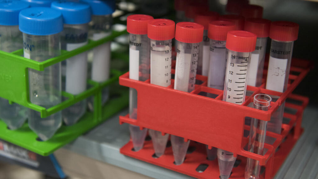 O câncer do sangue pode se desenvolver de maneira silenciosa, mas um simples hemograma já pode detectar sinais da doença